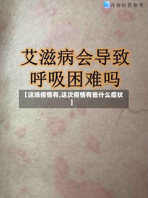 【这场疫情有,这次疫情有些什么症状】